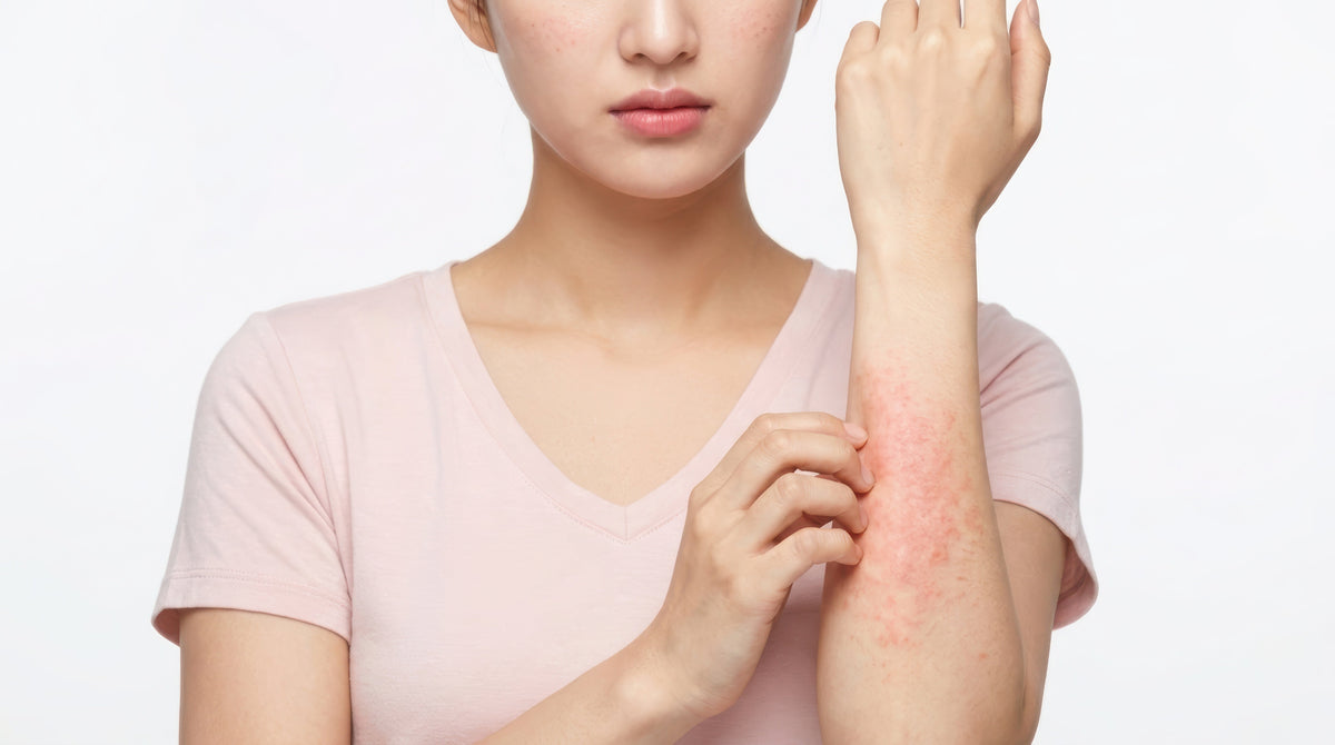 Understanding MCAS and Histamine Intolerance: Symptoms, Triggers, and Effective Management Tips