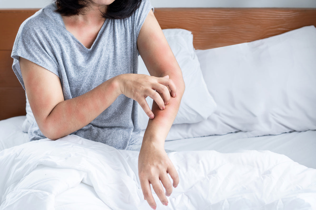 The Histamine-Itch Connection: Causes, Symptoms, and How to Care for Your Skin