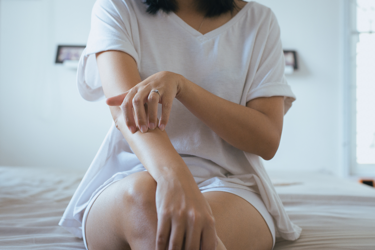 5 Histamine Intolerance Supplements†