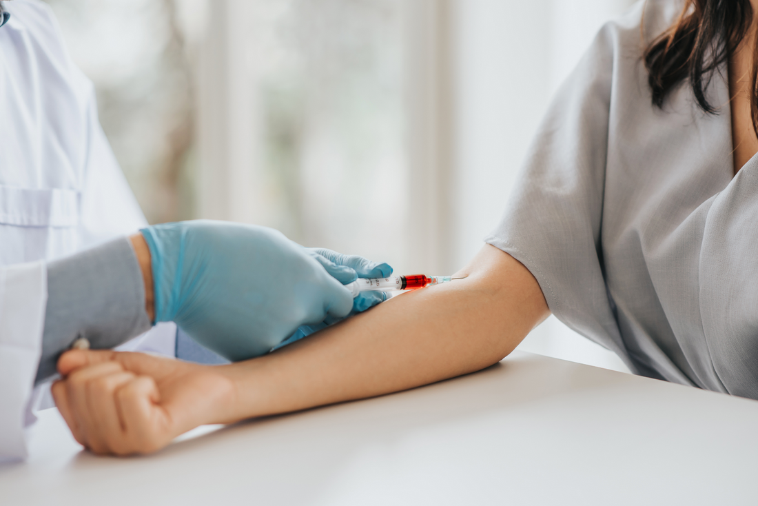 Methylmalonic acid: the forgotten test that reveals your true B12 status