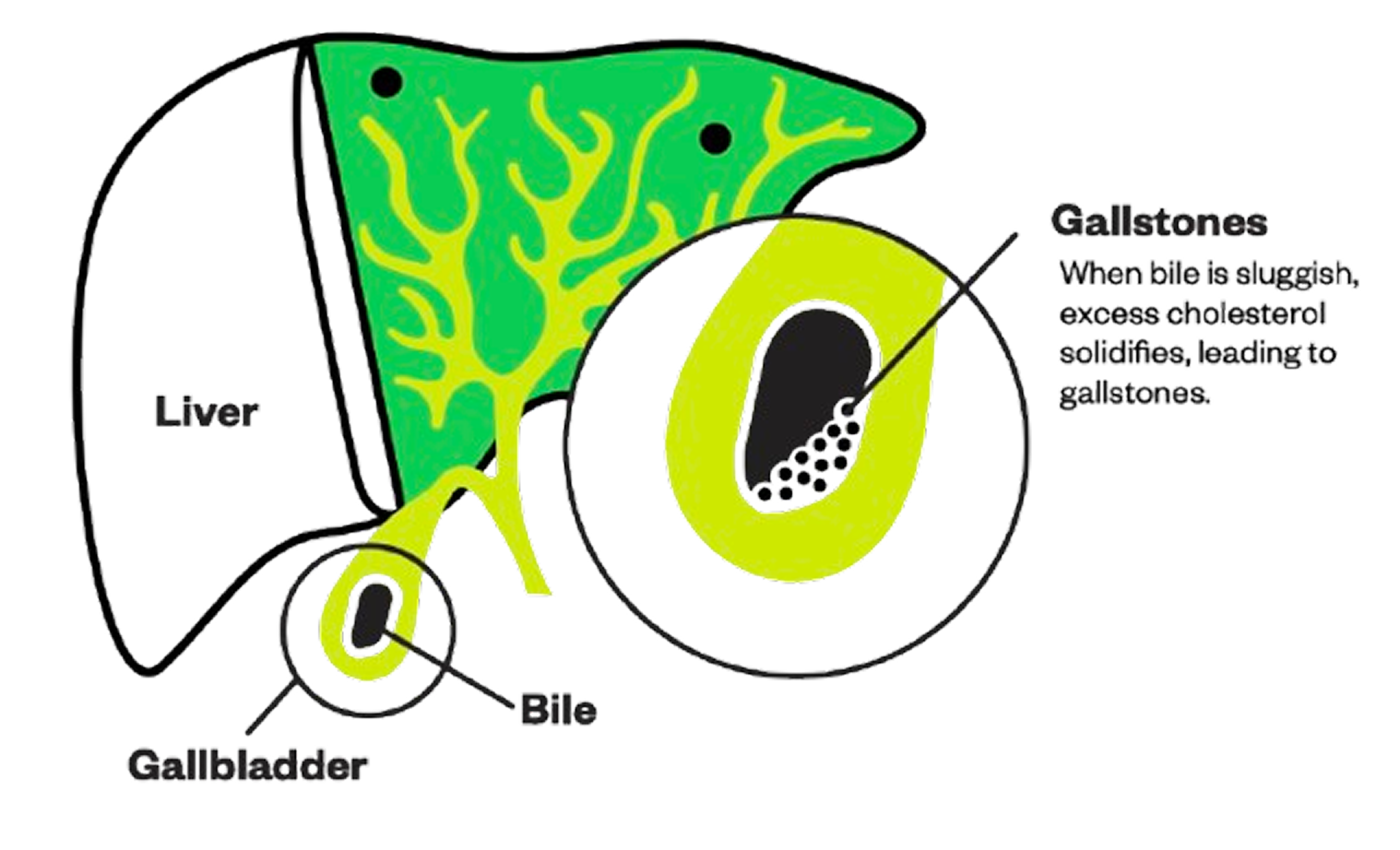 Gallbladder-Do